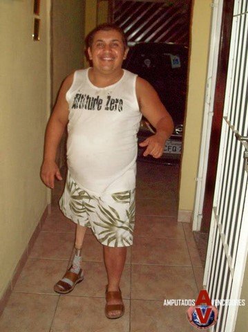 amputado rodolfo
