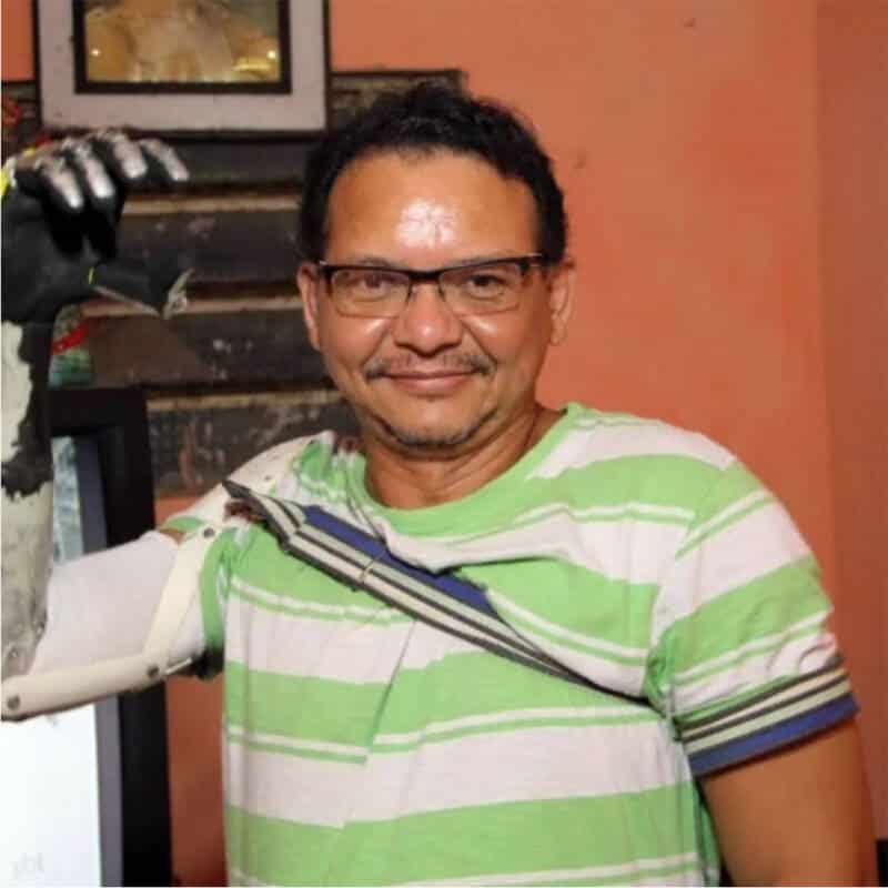 homem de lata ceara protese pvc jose erivelton